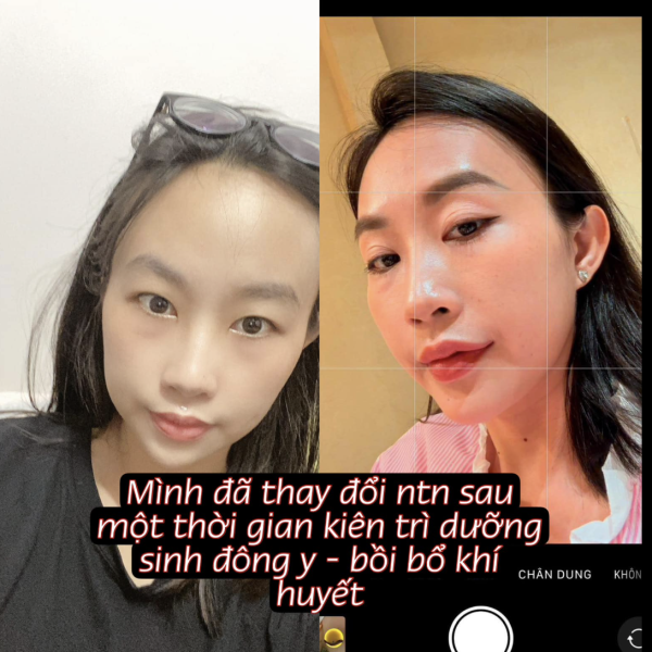 MÌNH ĐÃ THAY ĐỔI NHƯ THẾ NÀO KHI BIẾT ĐẾN DƯỠNG SINH ĐÔNG Y ???