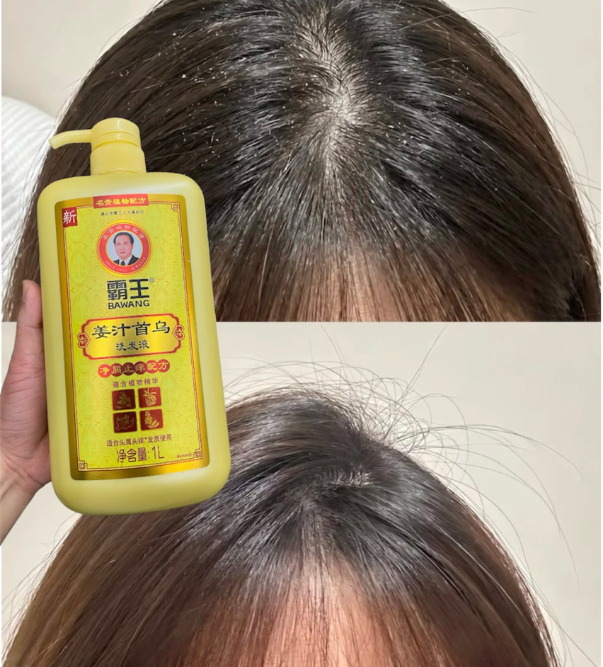 DẦU GỘI BAWANG GỪNG - GIẢM NGỨA DA ĐẦU