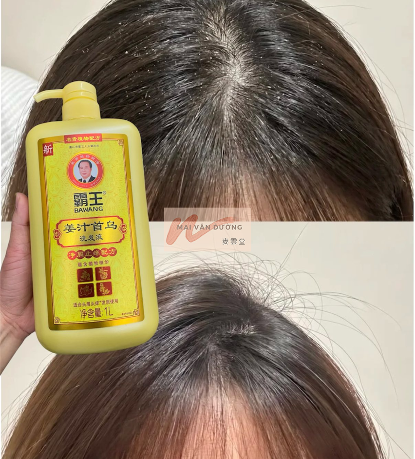 DẦU GỘI BAWANG GỪNG - GIẢM NGỨA DA ĐẦU